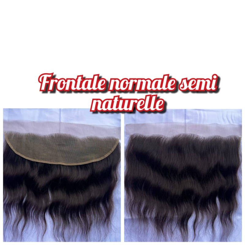 Frontal normal semi naturel