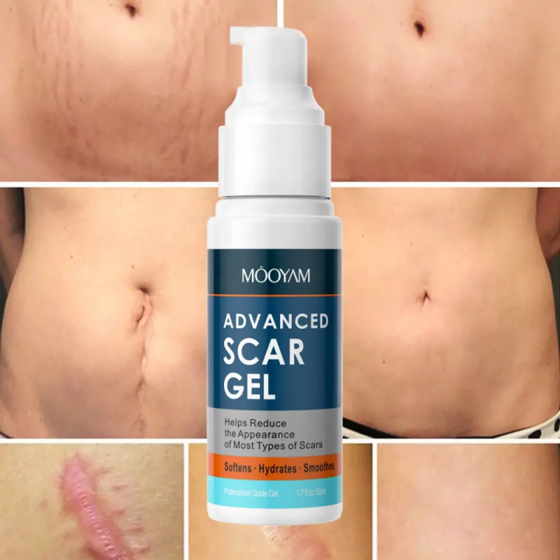 Gel cicatrice, Scar gel, gel cicatrisant