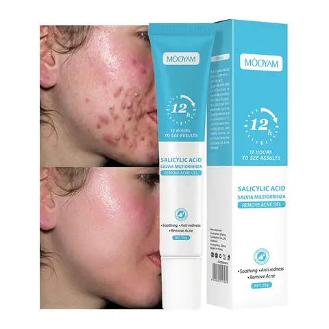 Crème visage anti boutons